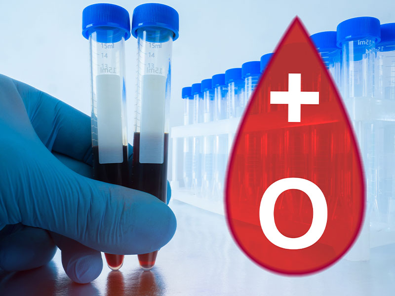 0 (Sıfır) Kan Grubu