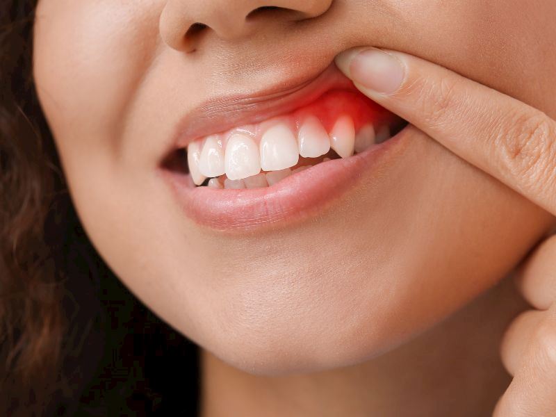 Diş Etlerini Sağlıklı Tutmanın 6 Yolu