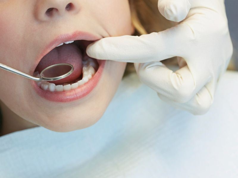 Dişlere Zarar Veren Alışkanlıklar Nelerdir?