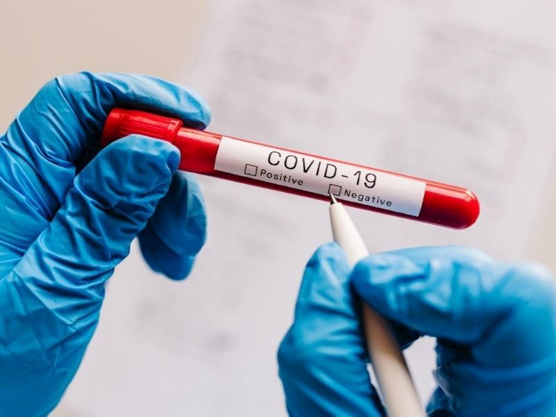 koronavirus geciren kisiler nasil beslenmeli koronavirus sonrasi icin beslenme onerileri
