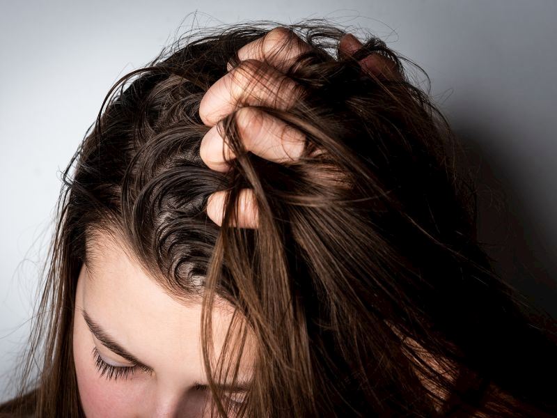 Saçım Neden Çabuk Yağlanıyor? Yağlı Saçlara İyi Gelen 15 Doğal Öneri